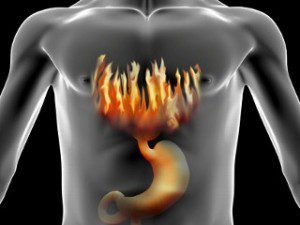 Natural Remedies for Heartburn | Wake Up World