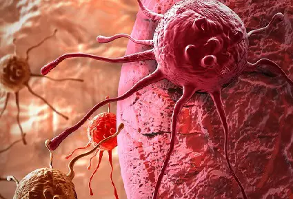 Research Shows Promising Effects Treating Advanced Cancer with Light Frequencies