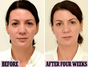 Drinking 3 Litres of Water Per Day Made This Woman Look Ten Years Younger
