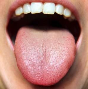 Tongue Diagnosis Made Easy 2
