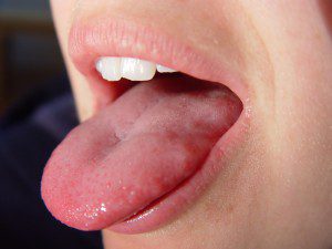Tongue Diagnosis Made Easy - Tongue