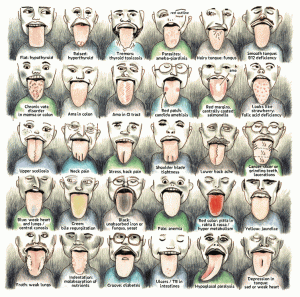 Tongue Diagnosis Made Easy - Tongue Chart