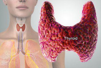 What You Need to Know About Treating Thyroid Conditions NATURALLY - Symptoms and Solutions